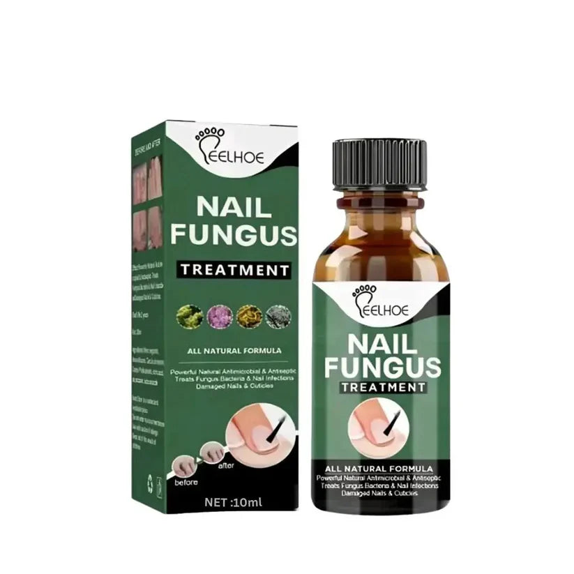 Nail Fungus Treatment -Advanced Antifungal Treatment
